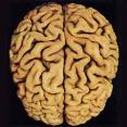 brains.jpg